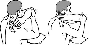 Selbstmassage bei Osteochondrose des Nackens