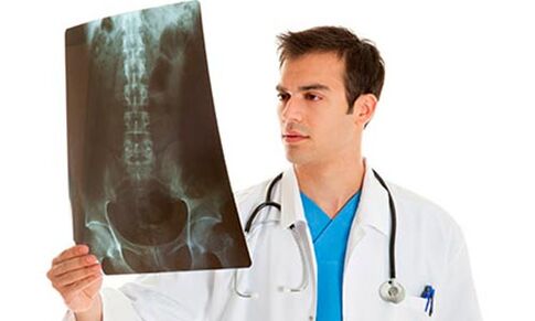 der Arzt sieht sich ein Röntgenbild an, um Kreuzschmerzen zu diagnostizieren